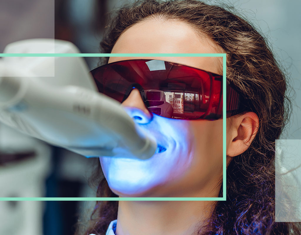 Blanqueamiento Dental Led Zoom Villalba