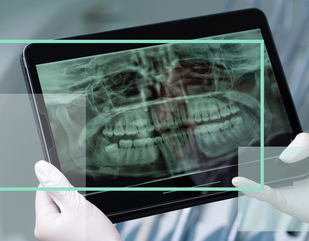 radiología digital collado-villalba