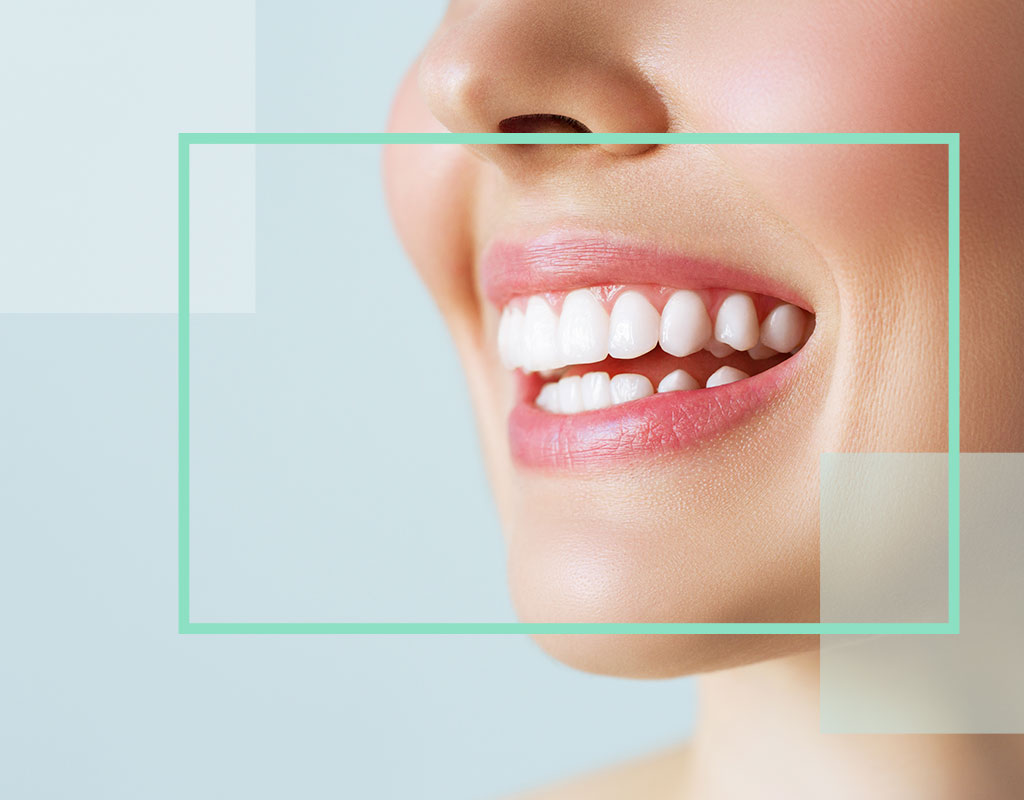 tratamientos diseño de sonrisa